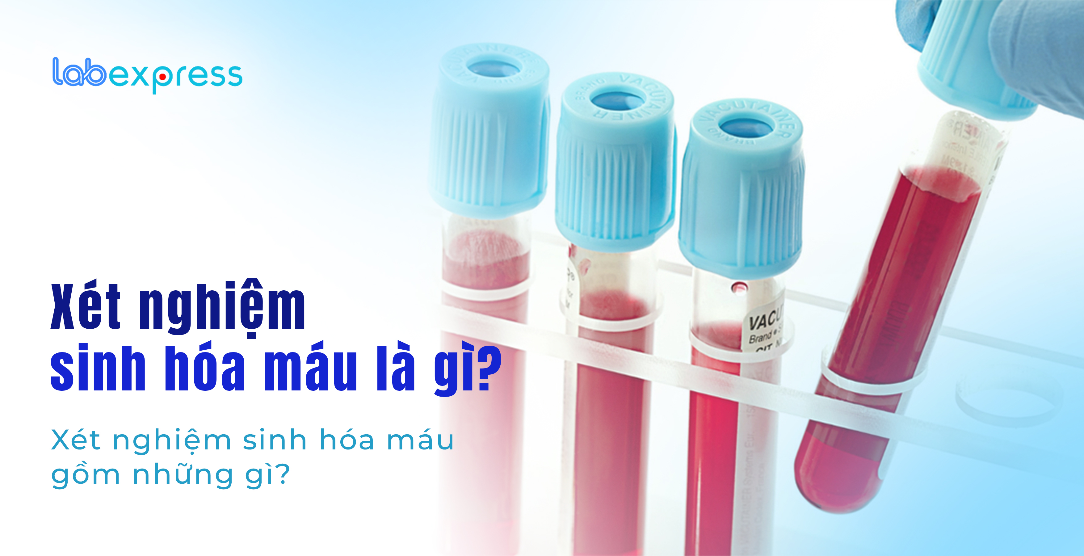 Xét nghiệm sinh hóa máu là gì? Xét nghiệm sinh hóa máu gồm những gì?