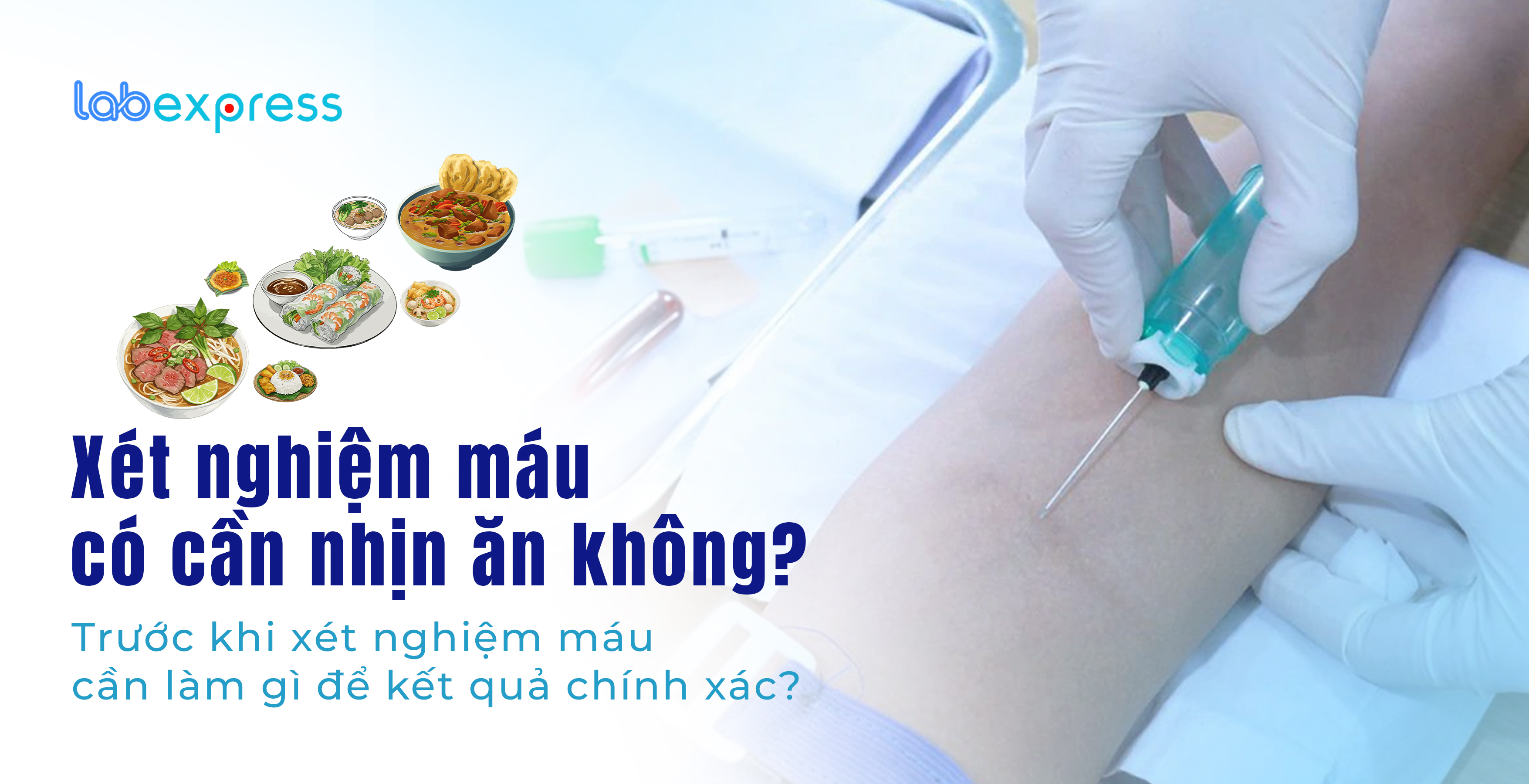 Xét nghiệm máu có cần nhịn ăn không? Trước khi xét nghiệm máu cần làm gì để kết quả chính xác?